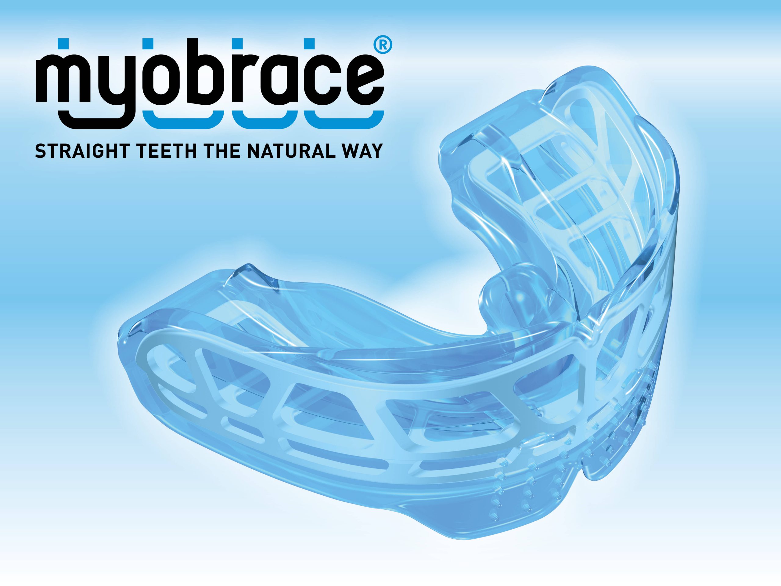 Myobrace-scaled